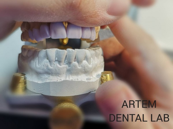 Artem Dental Lab AB